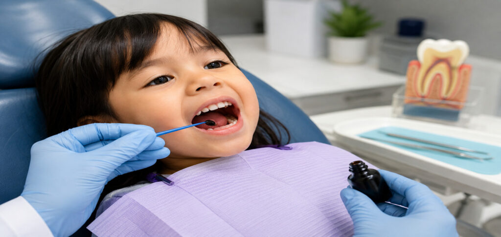 Drill-Free Cavity Treatment Stops Tooth Decay
