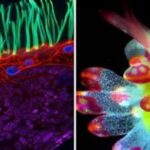 Allergies Later in Life: Why New Allergies Can Develop