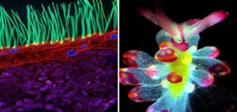 Allergies later in life linked to immune system changes