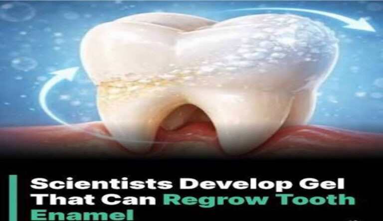 New protein-based gel regenerates and repairs damaged tooth enamel