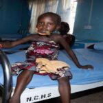 Noma Surgery Nigeria Gives Children New Hope